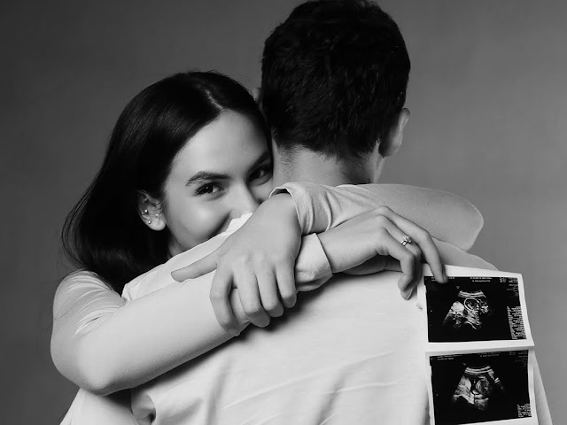 Steffi Zamora Umumkan Kehamilan Anak Nino Fernandez, Publik Terkejut